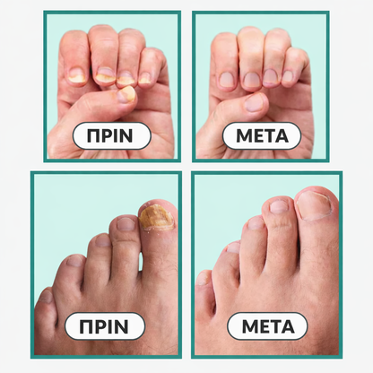 Συσκευή OrthoVital