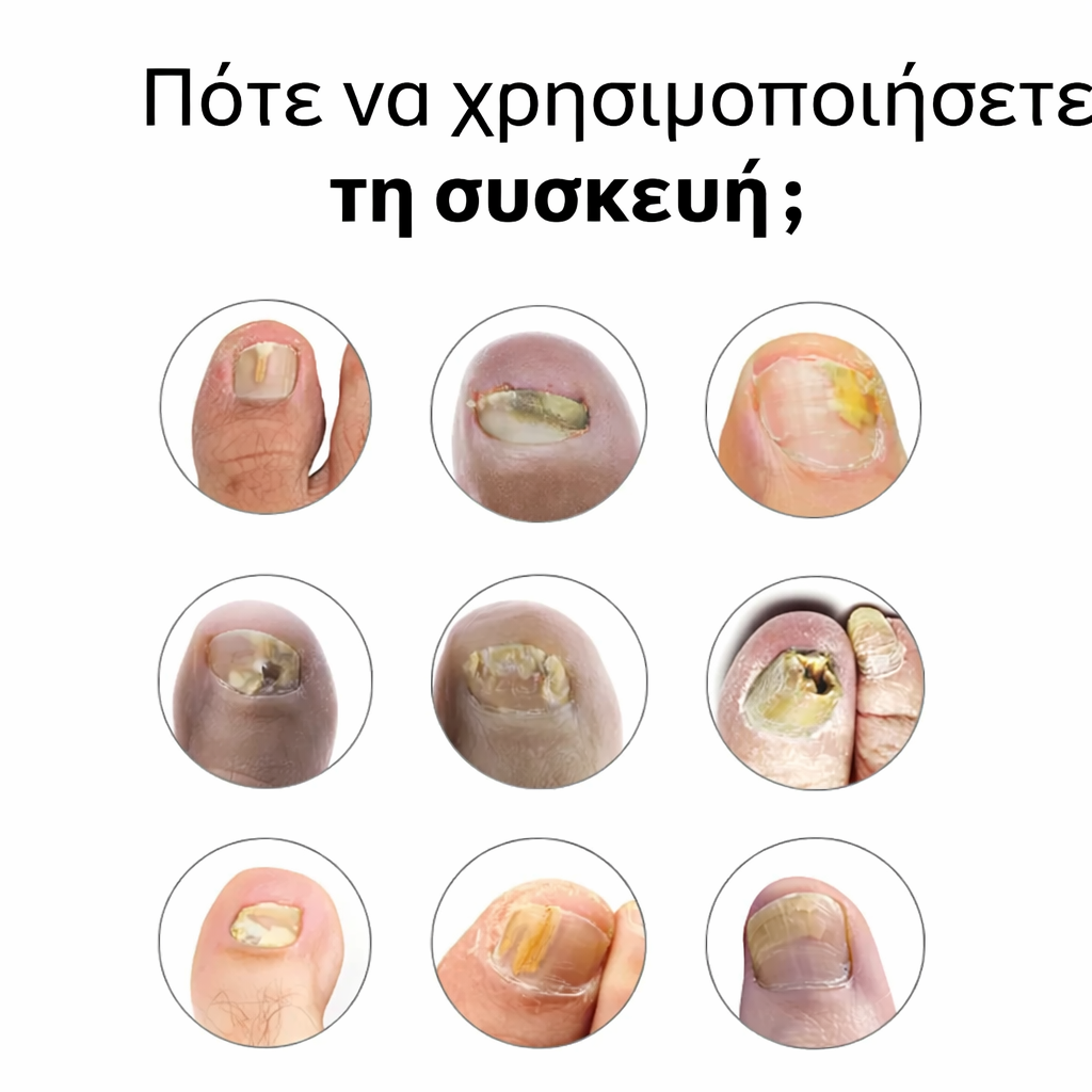 Συσκευή OrthoVital